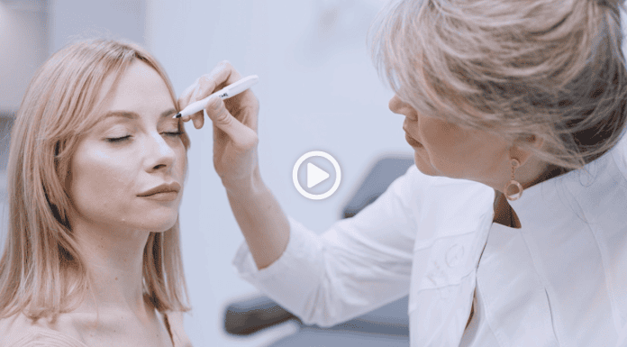 Blefaroplastika
